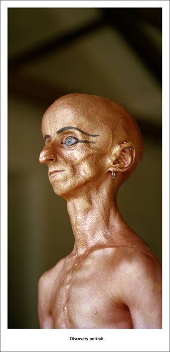 DJ Leon Botha и его страшная болезнь DJ Leon Botha и его страшная болезнь, прогерия