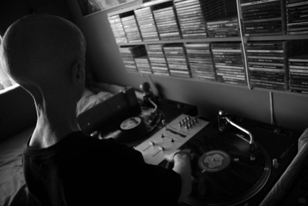 DJ Leon Botha и его страшная болезнь DJ Leon Botha и его страшная болезнь, прогерия