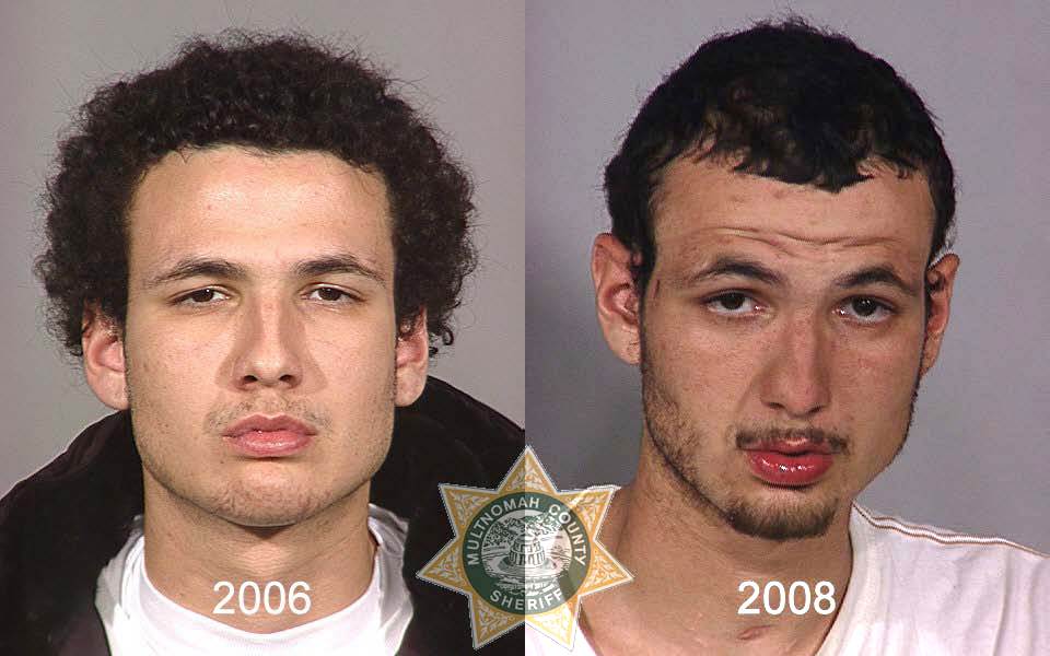 фото до и после наркотиков