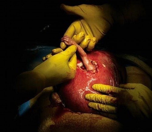 Фотографии, которые потрясли мир 