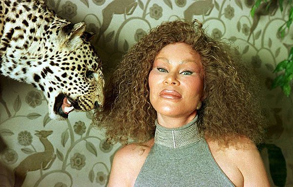  Джоселин Вайлд - жертва пластической хирургии