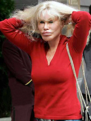  Джоселин Вайлд - жертва пластической хирургии