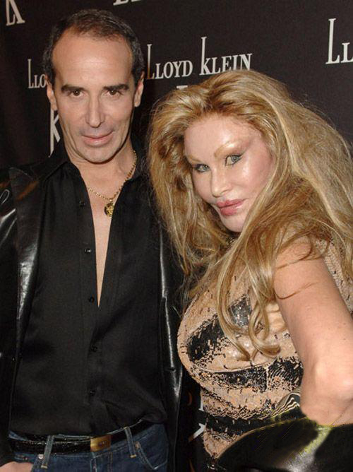  Джоселин Вайлд - жертва пластической хирургии