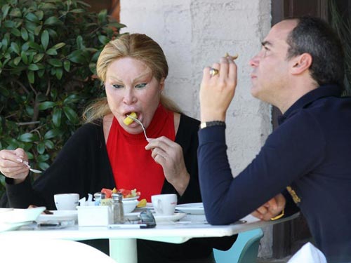  Джоселин Вайлд - жертва пластической хирургии