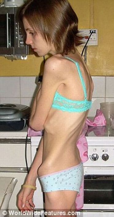 Отказаться от еды в 13 лет