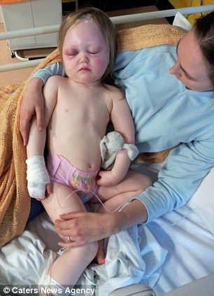 Девочка была на один миллиметр от смерти