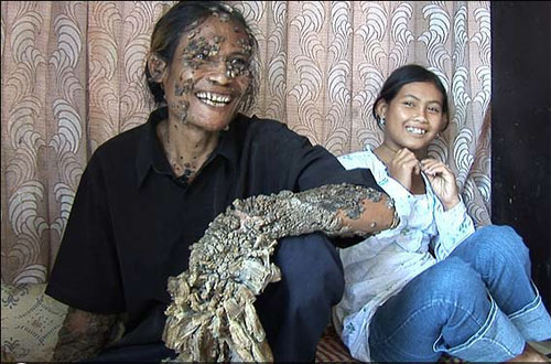 История человека - дерево