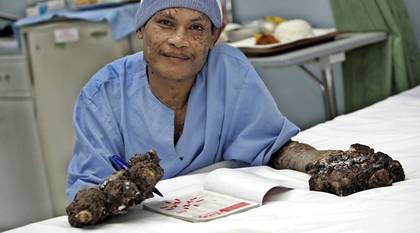 История человека - дерево