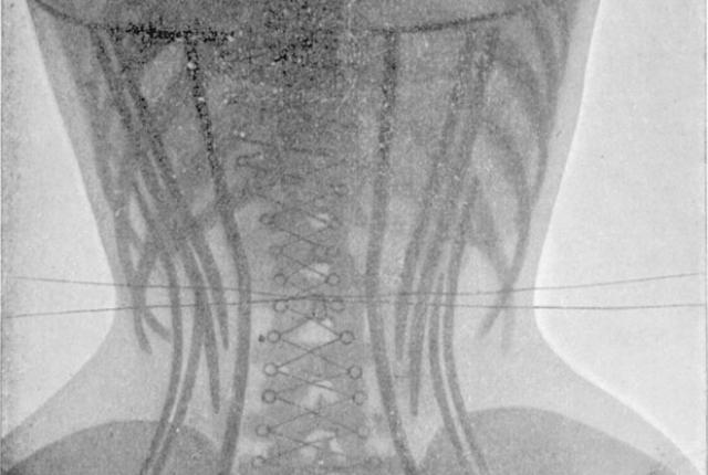 жертвы ради красоты, прошлое