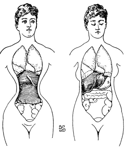 жертвы ради красоты, прошлое