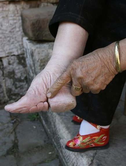 жертвы ради красоты, прошлое