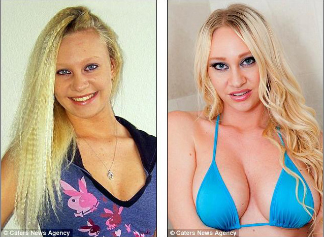 американка, увеличила, грудь, пластика,операция 