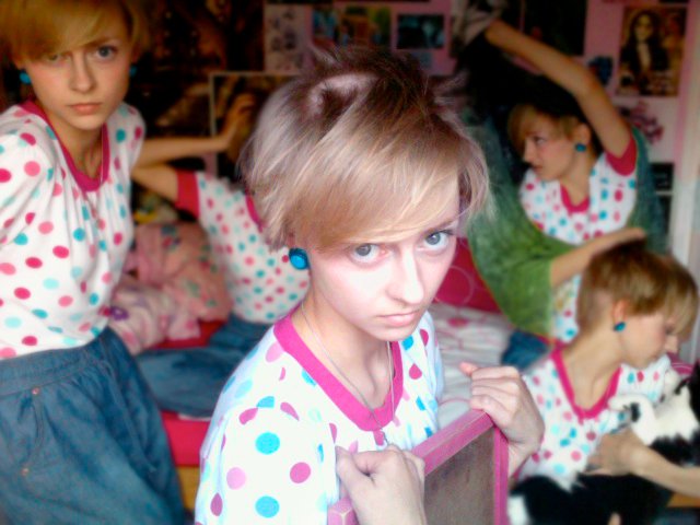 Трихотилломания, болезнь, Ребекка Браун, выдёргивать волосы, rebecca brown trichotillomania