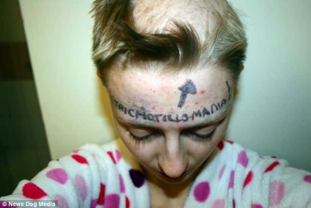 Трихотилломания, болезнь, Ребекка Браун, выдёргивать волосы, rebecca brown trichotillomania