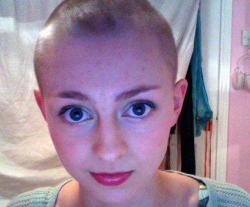 Трихотилломания, болезнь, Ребекка Браун, выдёргивать волосы, rebecca brown trichotillomania