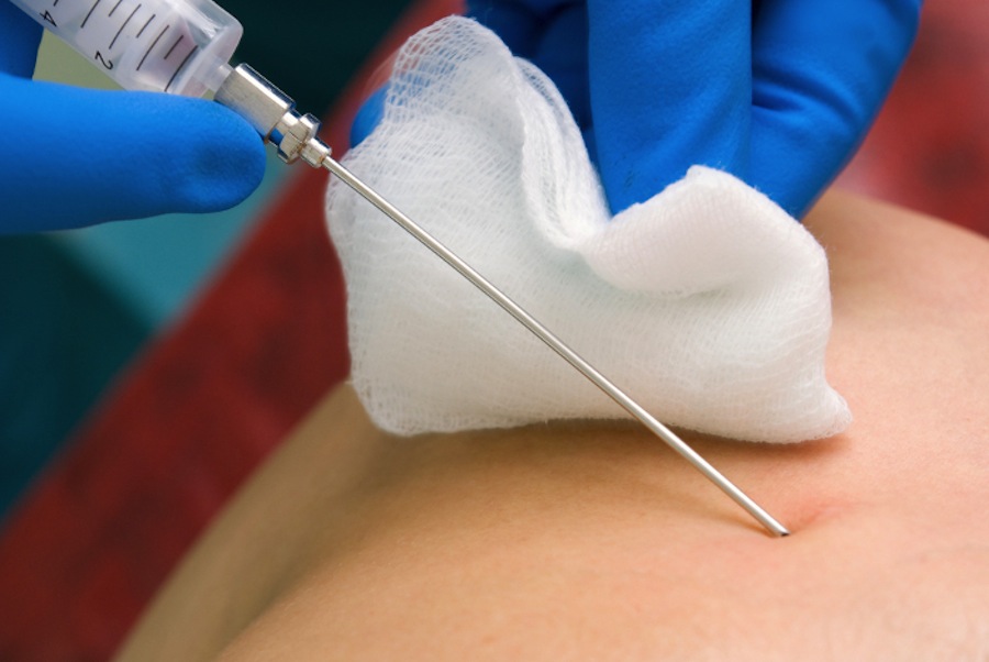 странные, способы, борьба, лишний вес, в разных странах