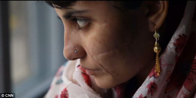 Жизнь после 15 ударов топором Девушка, шрамы, 15 ударов топором, Гюль,Пакистан, афганистан