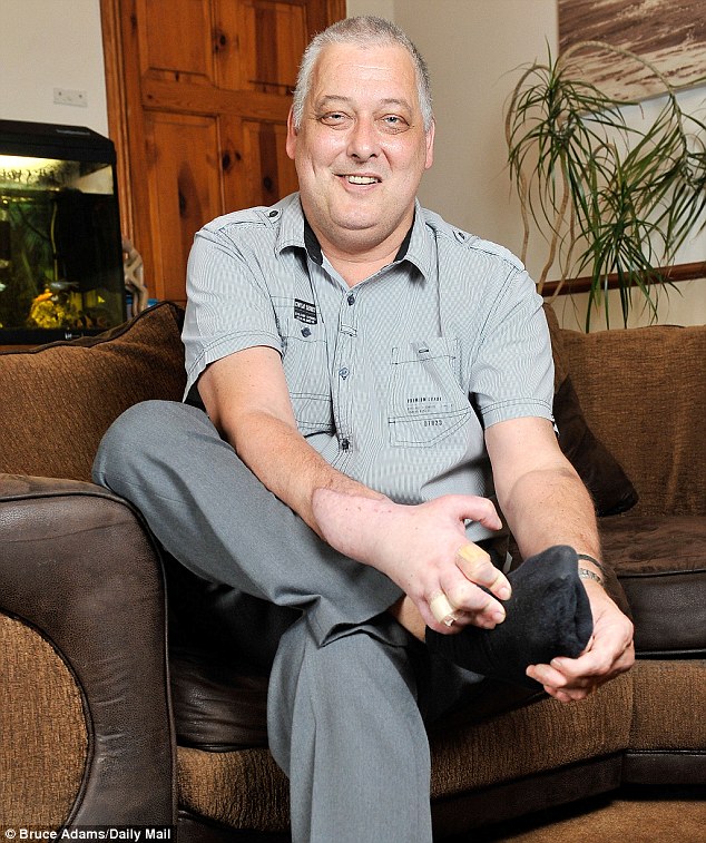 Пересадка руки, в Великобритании ,Марк Кэхилл