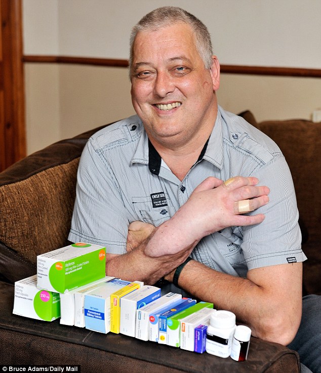 Пересадка руки, в Великобритании ,Марк Кэхилл