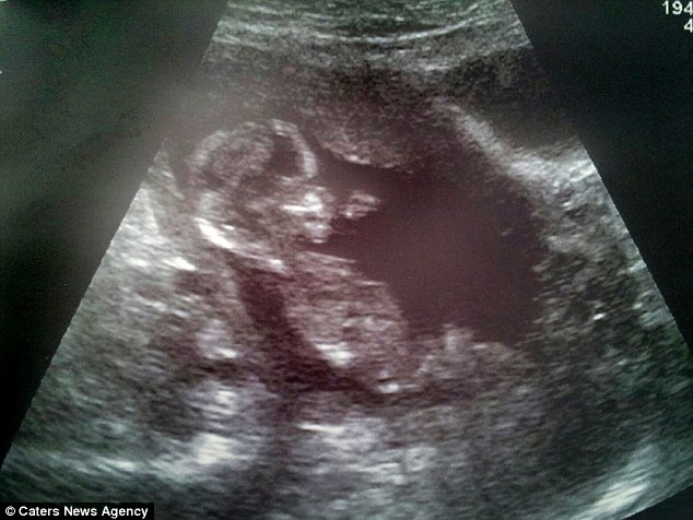 Более 150 тыс.руб. на детские вещи для не родившейся девочки, а родился.. Ждали девочку,родился мальчик, одежда, комната, Лили-Мэй, Lily May