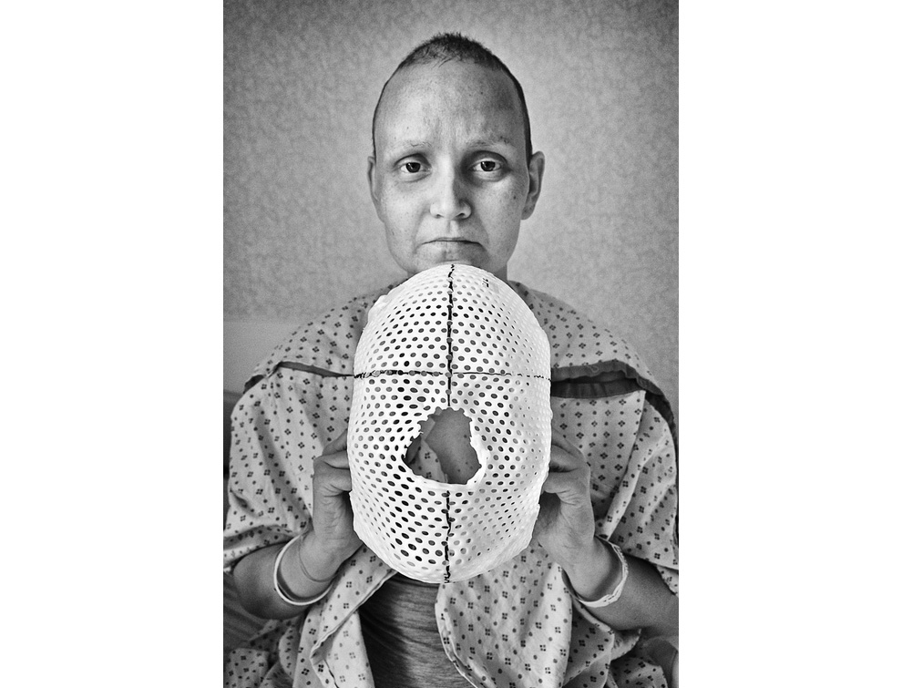 Борьба с раком, Дженнифер Мерендино, Jennifer Merendino, фото