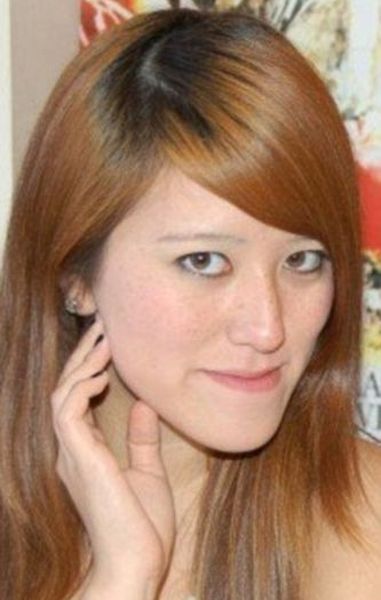 Софи Йейтс, новое лицо, пластическая, ортогнатическая, хирургия