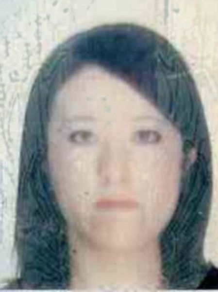 Софи Йейтс, новое лицо, пластическая, ортогнатическая, хирургия