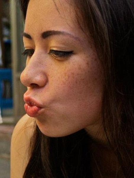 Софи Йейтс, новое лицо, пластическая, ортогнатическая, хирургия