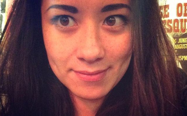 Софи Йейтс, новое лицо, пластическая, ортогнатическая, хирургия