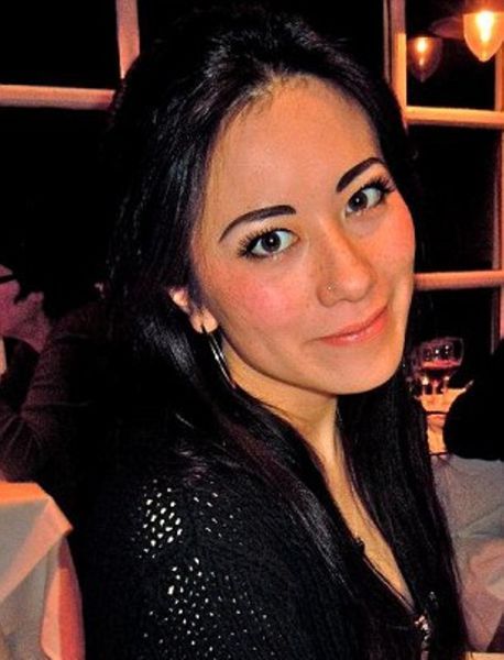 Софи Йейтс, новое лицо, пластическая, ортогнатическая, хирургия