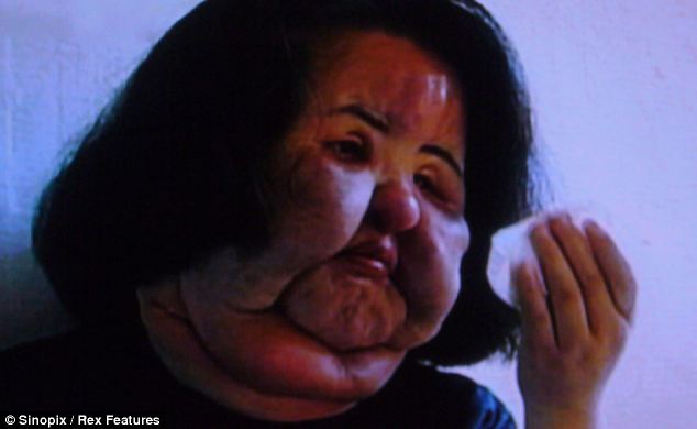 Жесть, шок, пластические операции, медицина, Ханг Миоку, корейская певица, инъекции силикона, девушка из Кореи