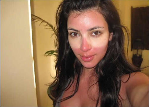 Крайне неудачный загар Смешной,неудачный, загар ,летом,от солнца