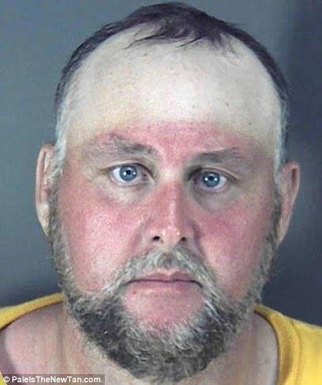 Крайне неудачный загар Смешной,неудачный, загар ,летом,от солнца