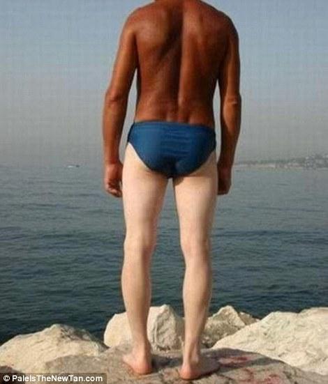 Крайне неудачный загар Смешной,неудачный, загар ,летом,от солнца