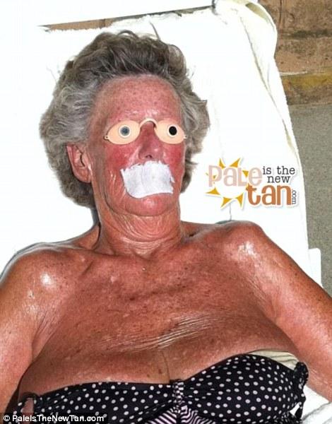 Крайне неудачный загар Смешной,неудачный, загар ,летом,от солнца