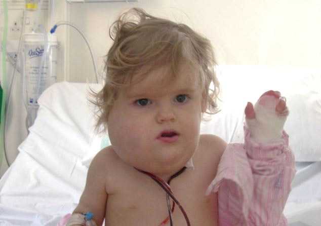 Несчастному ребёнку нельзя играть с детьми из-за болезни Лорен Купер, киста,болезнь