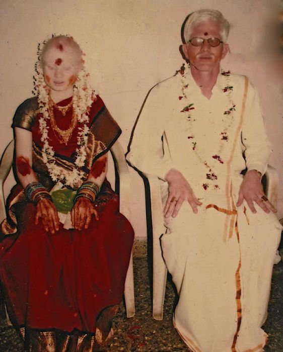 Семья, альбиносов, Пулланс, из Индии, Pullans