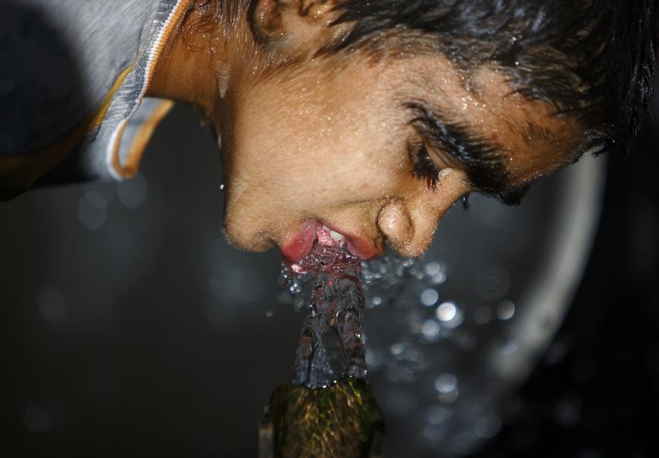 Семья с «синдромом оборотня» обрела человеческий облик «синдром оборотня», гипертрихоз, лазерная эпиляция