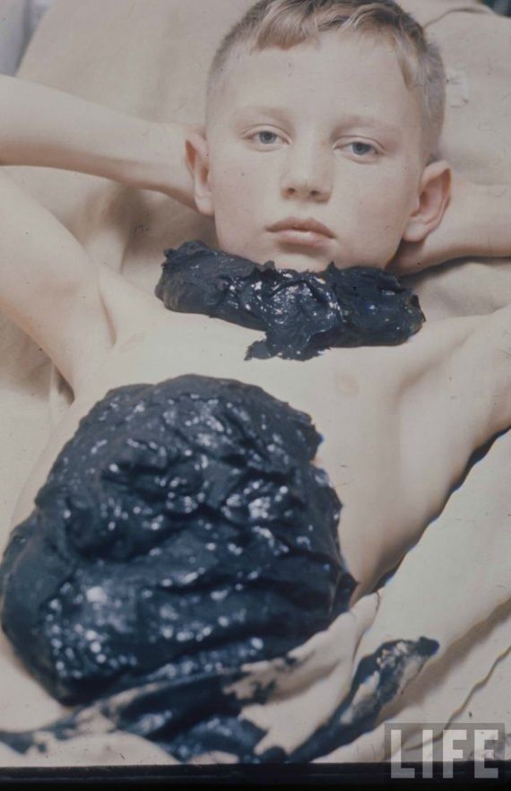 Какой была медицина в советское время