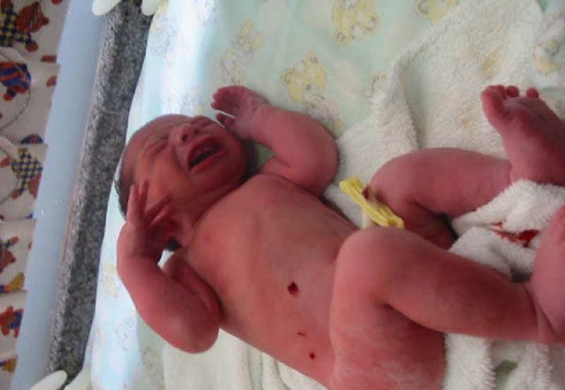 выжившие дети, 7 историй выживания младенцев