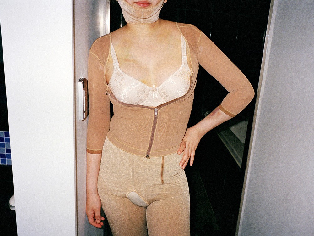 Девушки, после пластических операций, Джи Йео, проект Красота