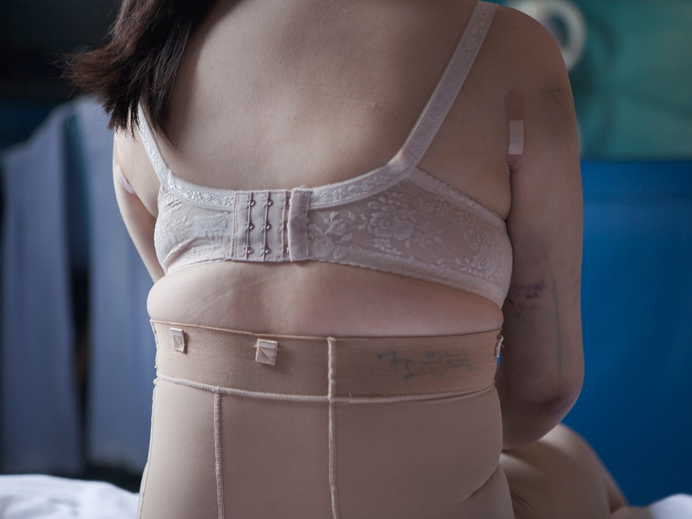 Девушки, после пластических операций, Джи Йео, проект Красота