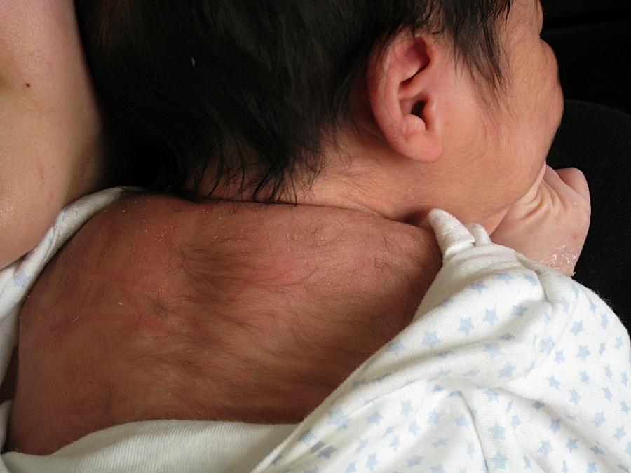 Жуткие человеческие болезни и мутации