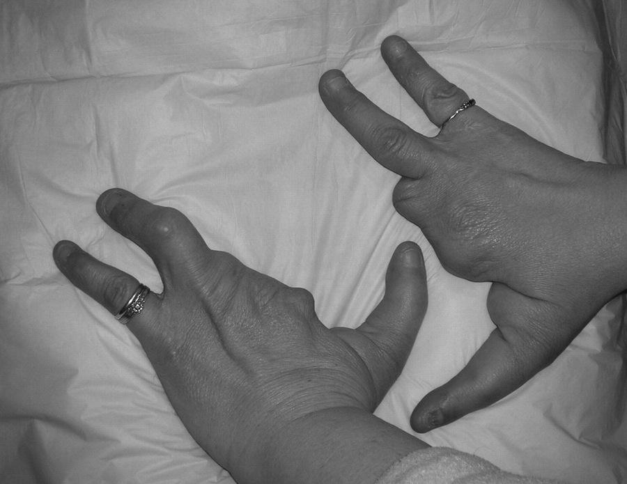 Жуткие человеческие болезни и мутации