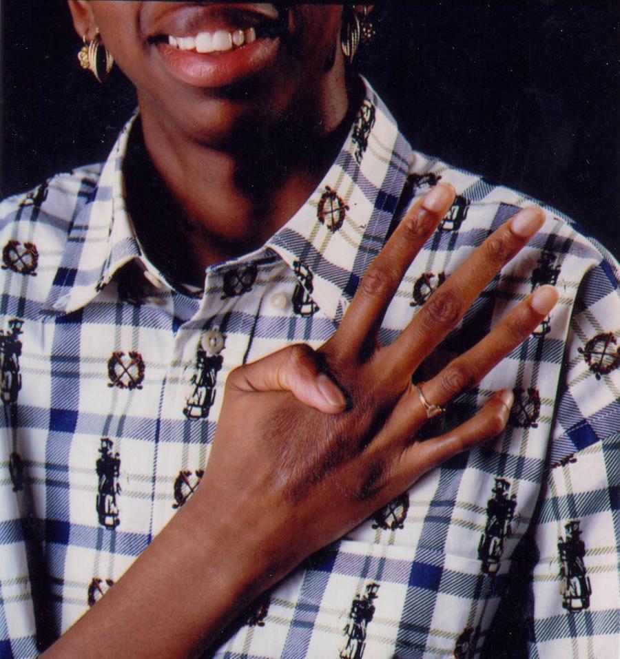 Жуткие человеческие болезни и мутации