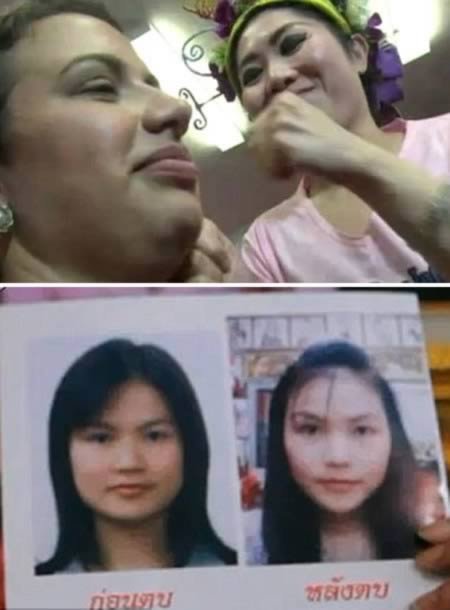 Самые нетрадиционные способы омоложения изощрённые способы омоложения, нетрадиционные