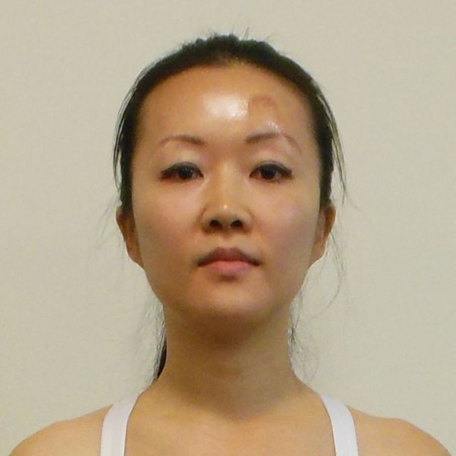 Чайна Чуу, chyna chuu, аллергия, самолечение, импетиго