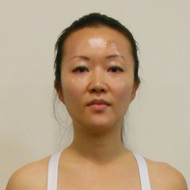 Чайна Чуу, chyna chuu, аллергия, самолечение, импетиго