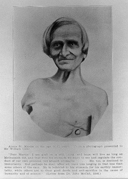 Интересные факты о вашей пищеварительной системе Интересные факты, о пищеварительной системе