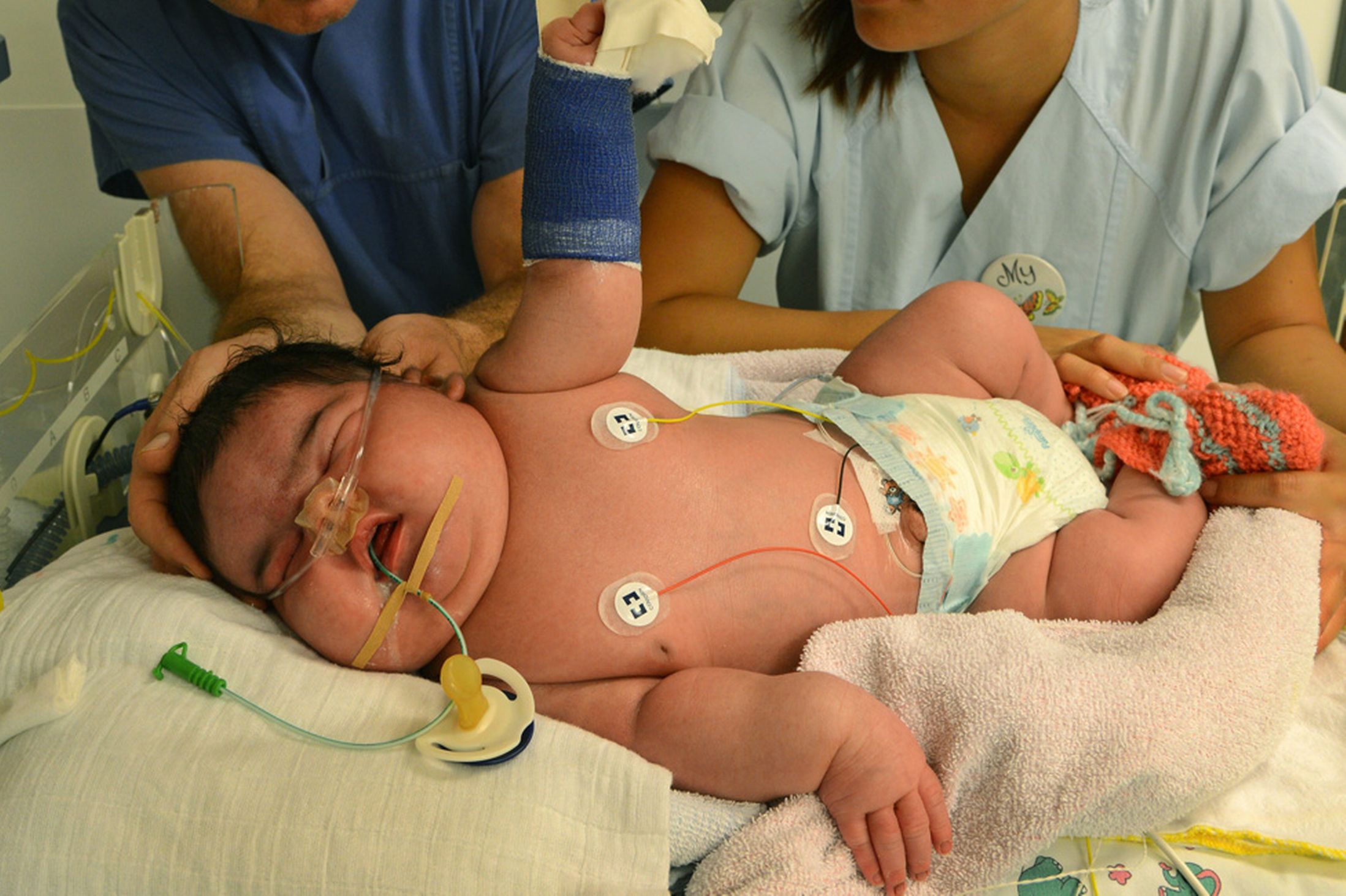 Младенцы-рекордсмены родившиеся с весом более 6 кг